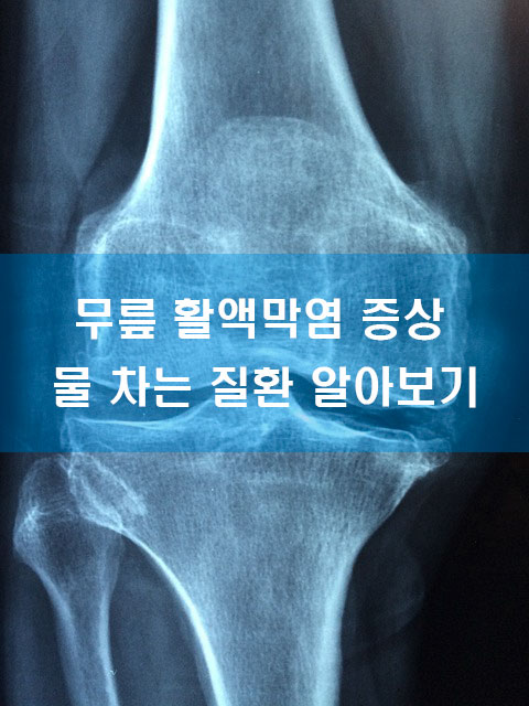 무릎 활액막염 증상