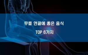 무릎 연골에 좋은 음식