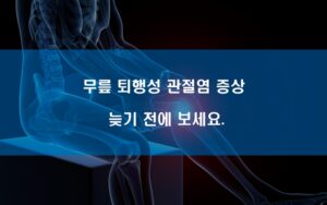무릎 퇴행성 관절염 증상